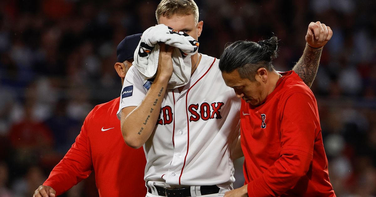 Tanner Houck to Undergo Surgery to Repair Facial Fracture with Plate Insertion